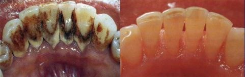 微信图片_20250307095437 微信图片_20250307095437