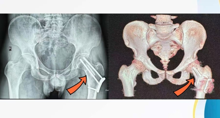 微信图片_20250310114341 微信图片_20250310114341