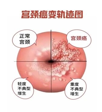 微信图片_20250408084338 微信图片_20250408084338