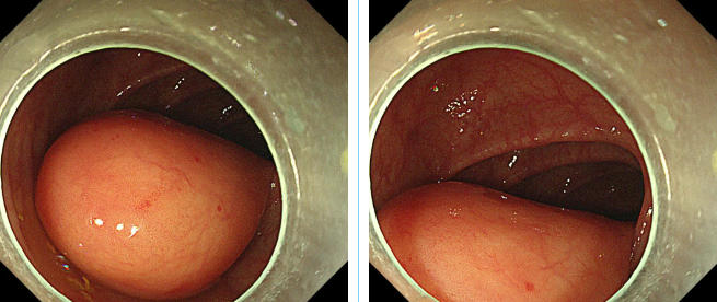 wechat_2025-06-09_082235_318 wechat_2025-06-09_082235_318