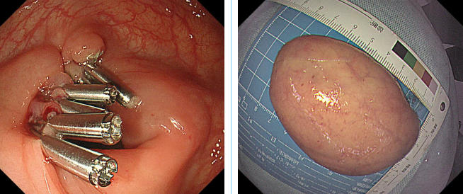 wechat_2025-06-09_082253_895 wechat_2025-06-09_082253_895