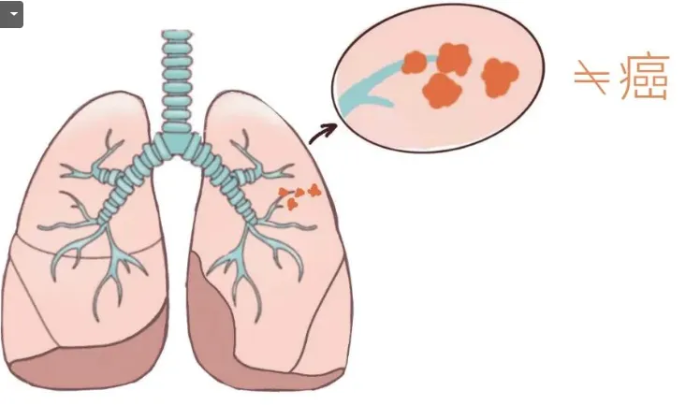 20a7acb722f46bb2dc519b7c13b83c7a 20a7acb722f46bb2dc519b7c13b83c7a