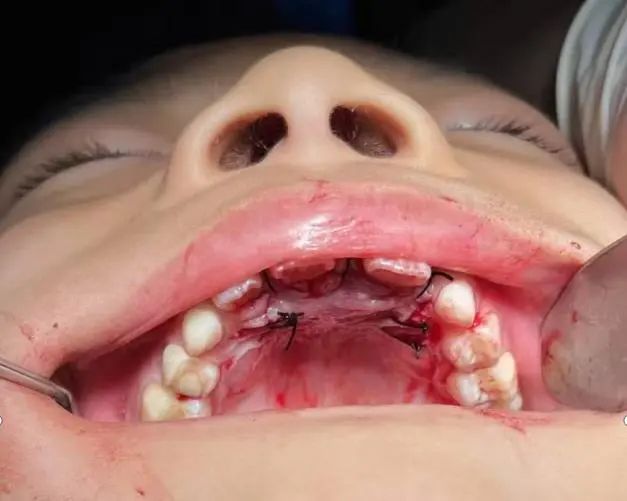 微信图片_2025-07-28_084445_693 微信图片_2025-07-28_084445_693