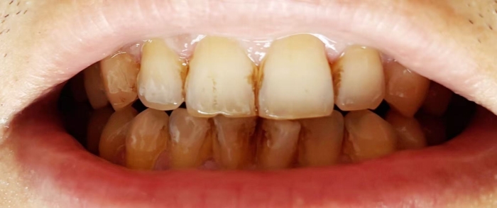 微信图片_2025-07-31_140617_011 微信图片_2025-07-31_140617_011