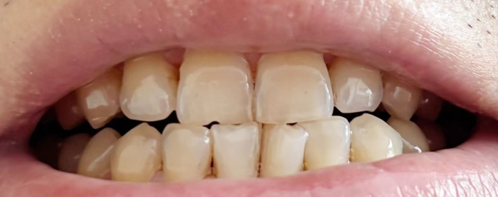 微信图片_2025-07-31_140555_234 微信图片_2025-07-31_140555_234