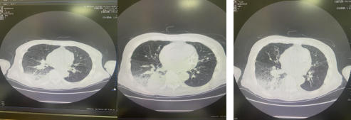 影像资料1 影像资料1