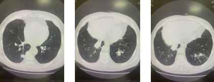 影像资料2 影像资料2