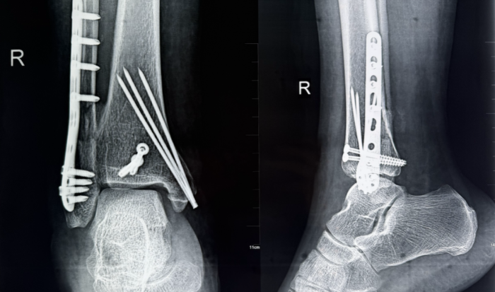 微信图片_2025-10-09_083645_254 微信图片_2025-10-09_083645_254