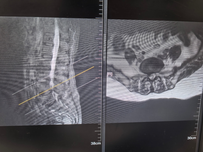 7ba9a0aa17dc6669e9848b1b3a66780c