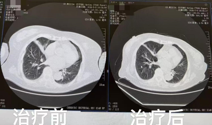图片222 图片222